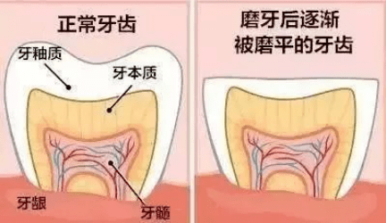 九个月大的宝宝磨牙现象解析