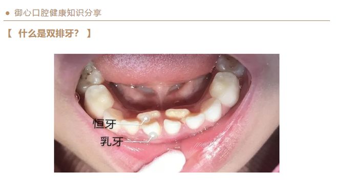 婴儿牙齿生长的时间表及其影响因素，深入了解婴儿几个月会长牙齿